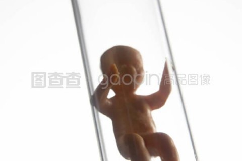http://zhongshan.vdtfzz.com/post/197.html|中山试管助孕
